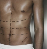 Los procedimientos est�ticos de moda